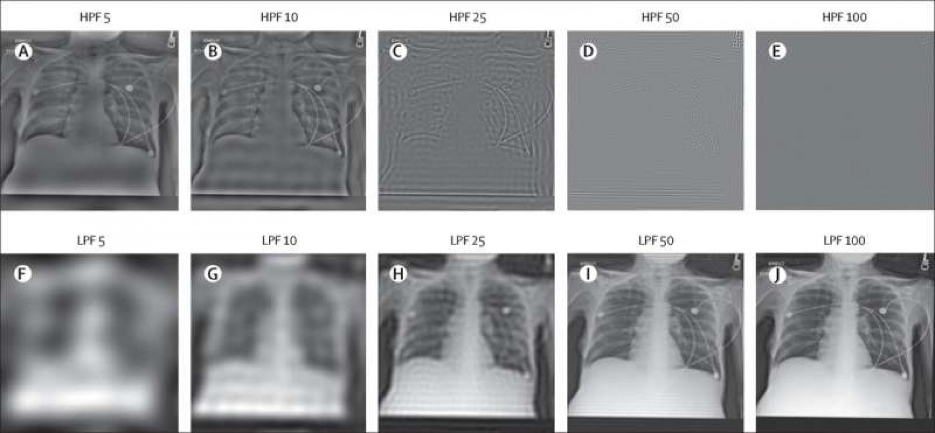 Artificial intelligence can determine racial identity from medical images Artificial intelligence can determine racial identity from medical images