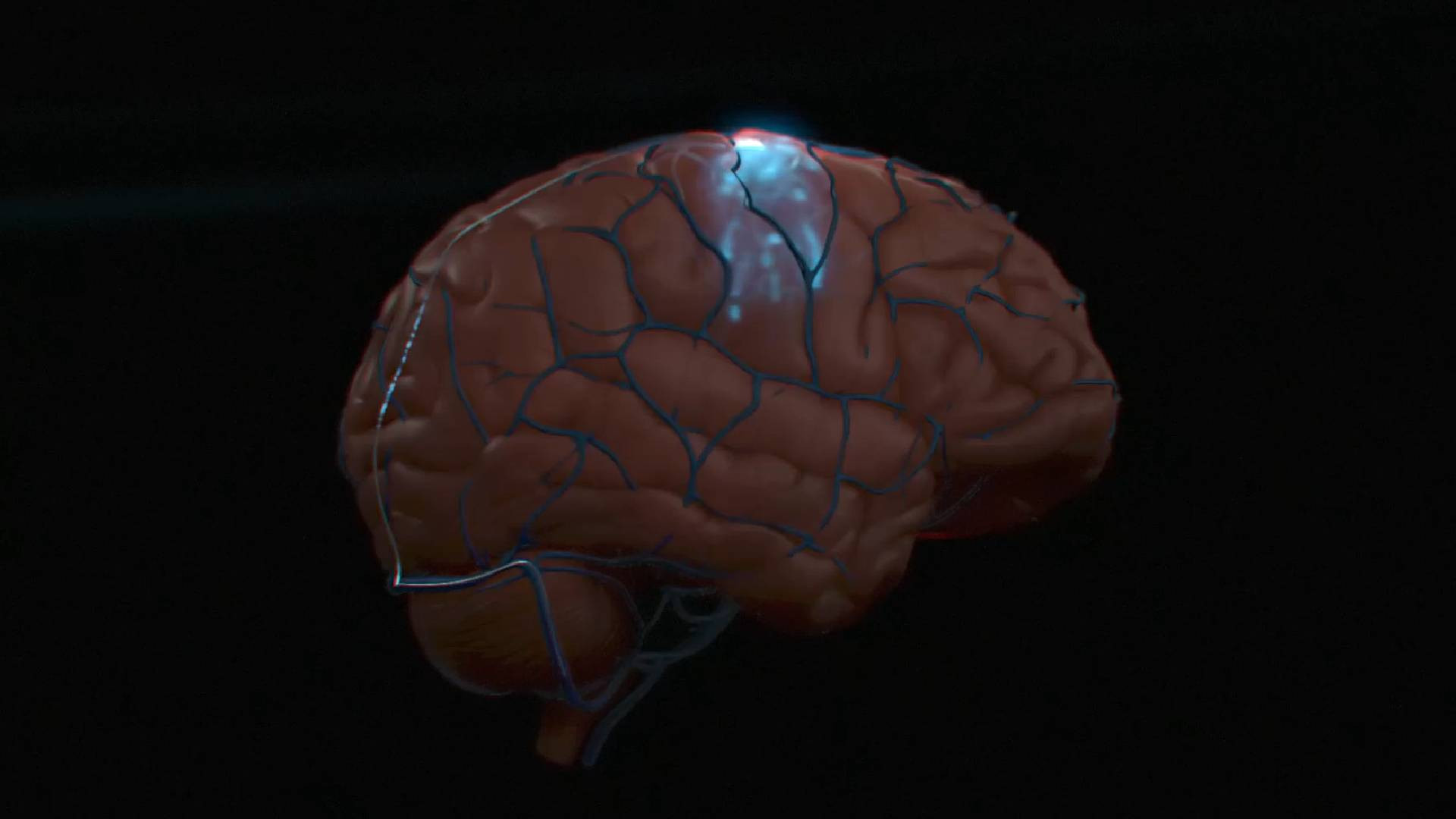 Paralyzed patients effectively control computer in a historic trial