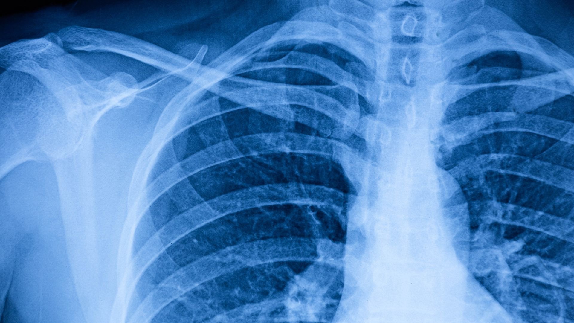 This AI tool is great at spotting abnormalities in chest Xrays