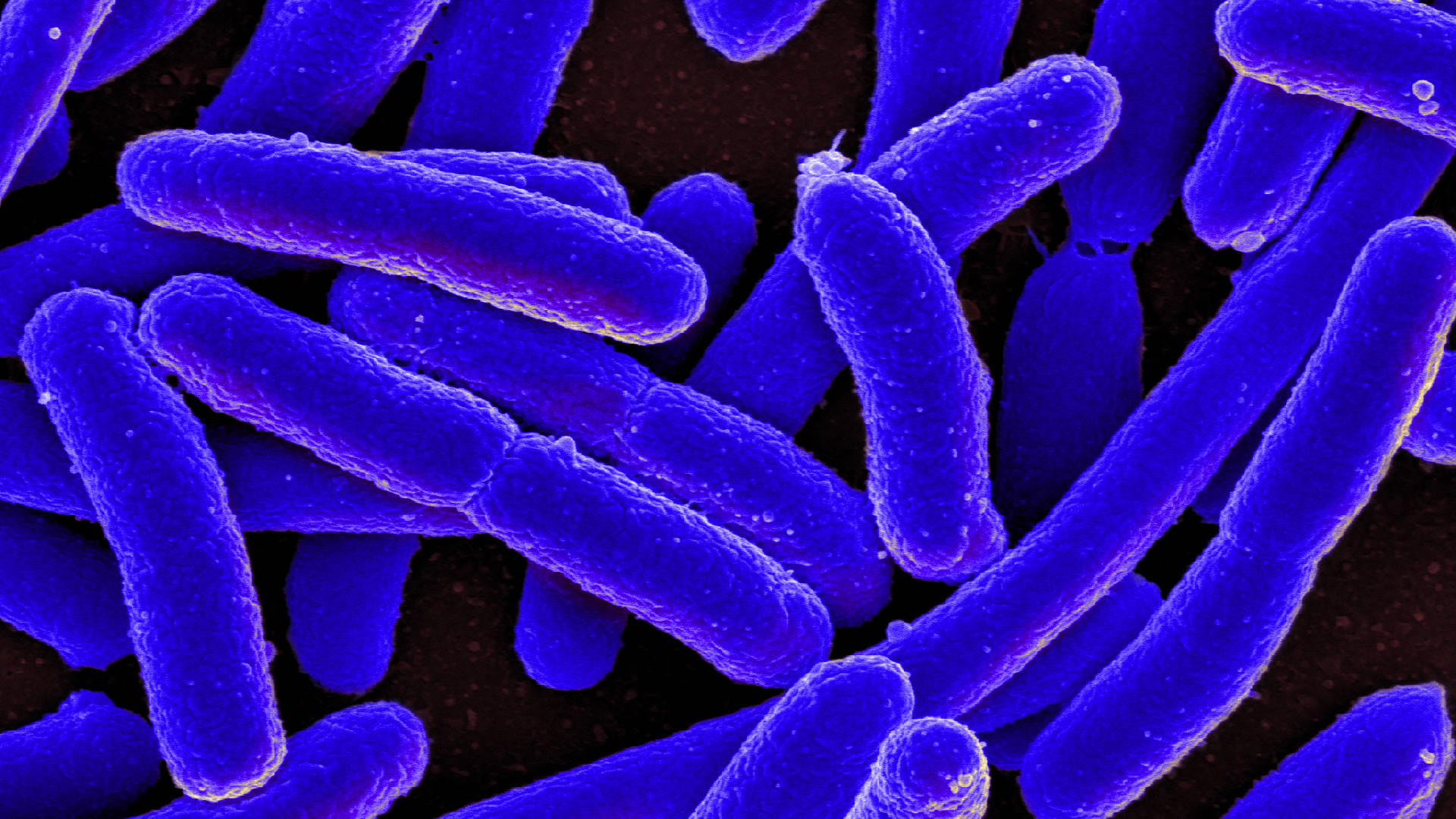 Here's how E. coli can be both good and bad for your health