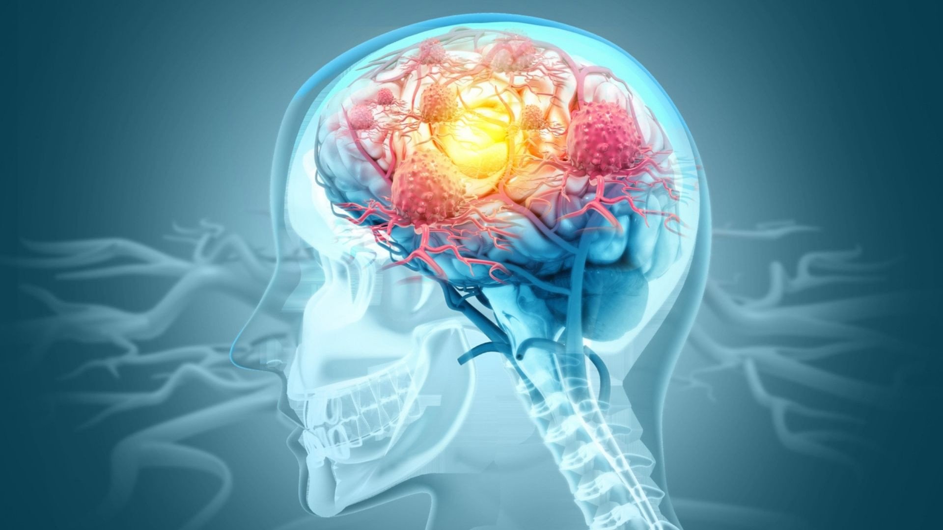 A brain injection filled with labgrown neurons promises to cure epilepsy