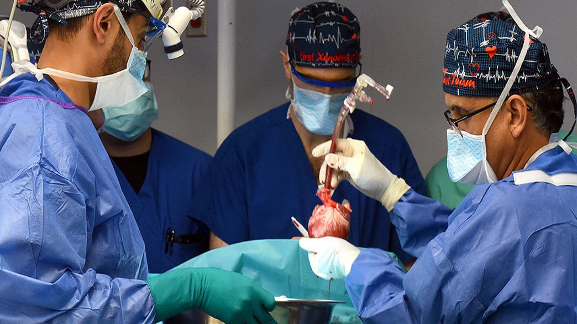 World's second pig heart transplant is a success