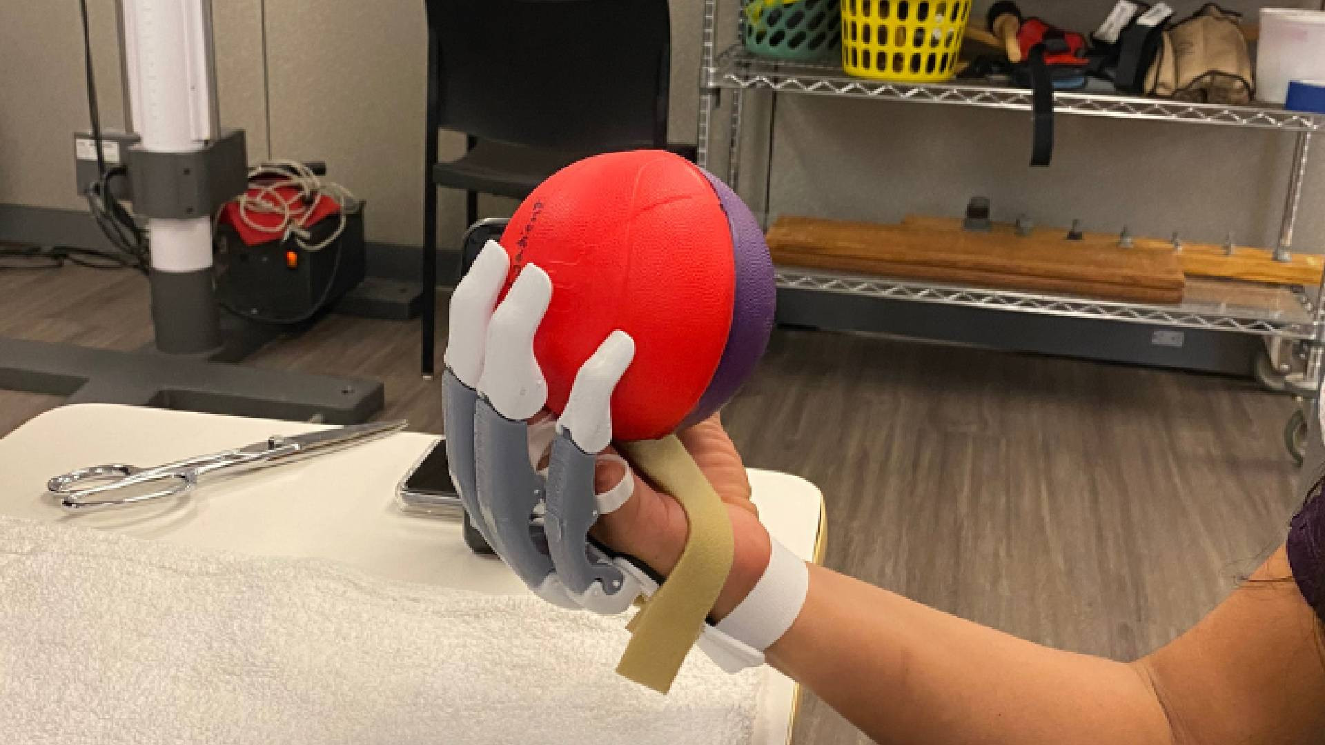 This award-winning 3D printable prosthetic is open access