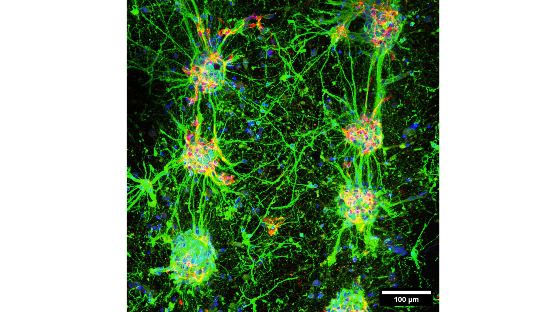 A Lab Just 3D-Printed a Neural Network of Living Brain Cells