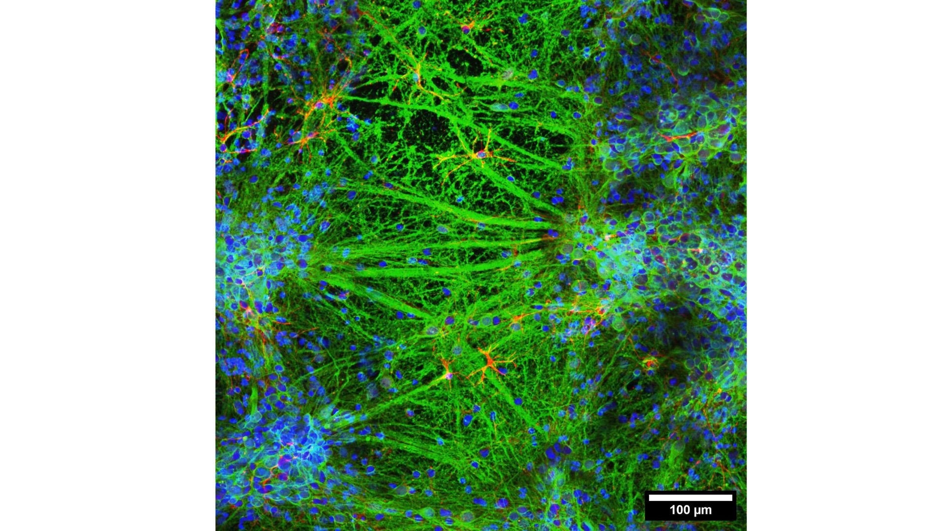 Scientists 3D-print living brain structures in a lab — why it matters