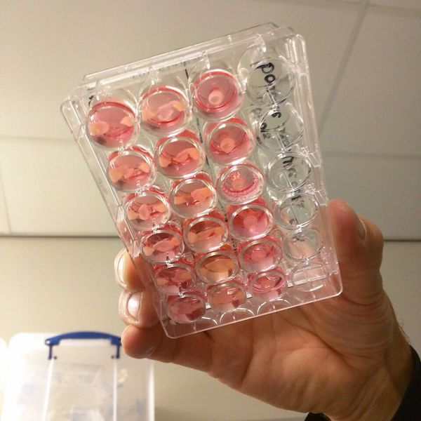 Here Are 5 Things You Should Know About Lab-grown Meat Here Are 5 Things You Should Know About Lab-grown Meat
