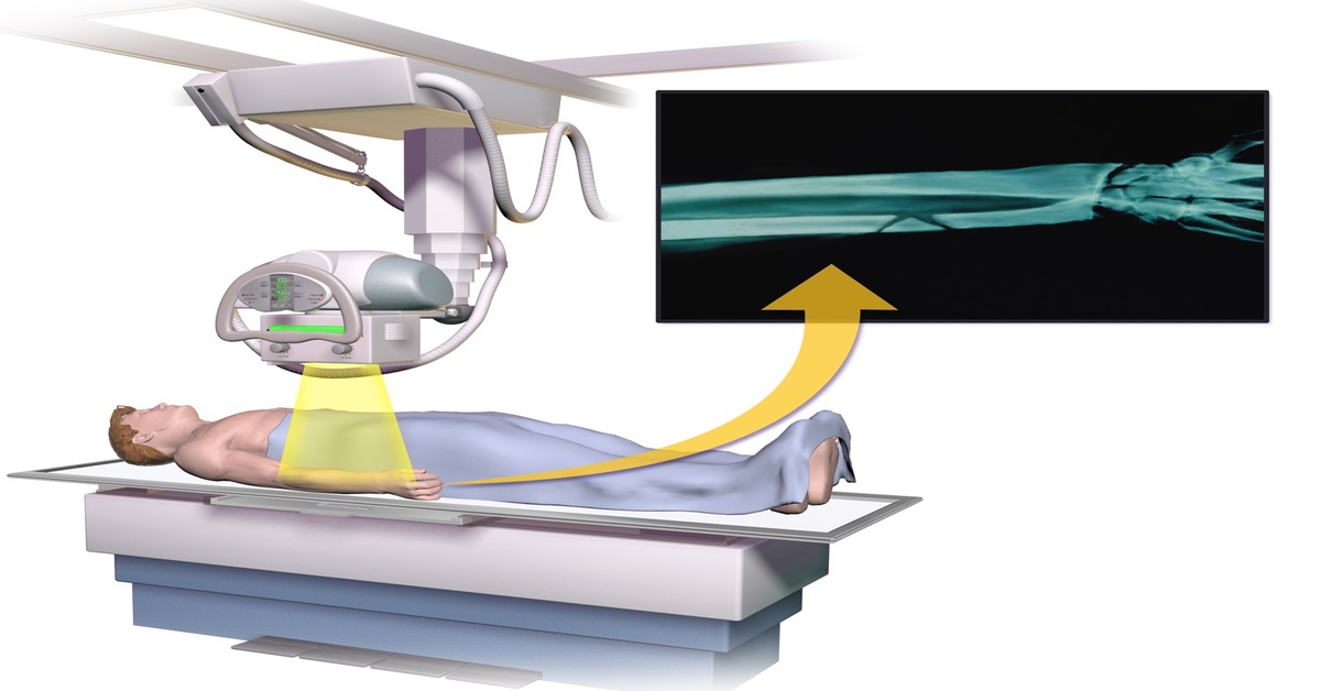 Everything You Need to Know About the X-Ray and Its Accidental History Everything You Need to Know About the X-Ray and Its Accidental History