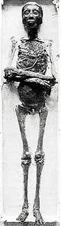 King Tutankhamun's mummy King Tutankhamun's mummy