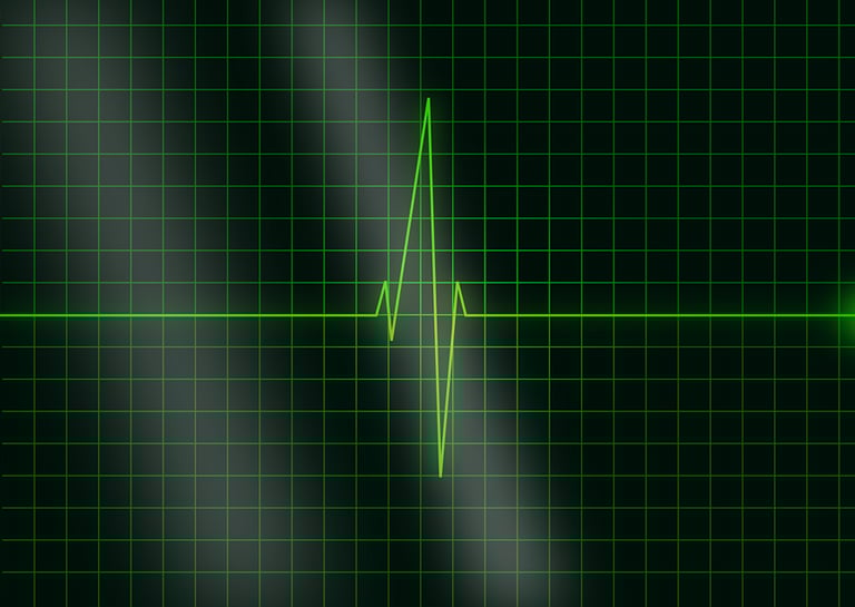 Your Heartbeat May Soon Become Your Password Your Heartbeat May Soon Become Your Password