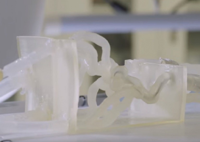 How a group of surgeons used 3D printing in brain surgery