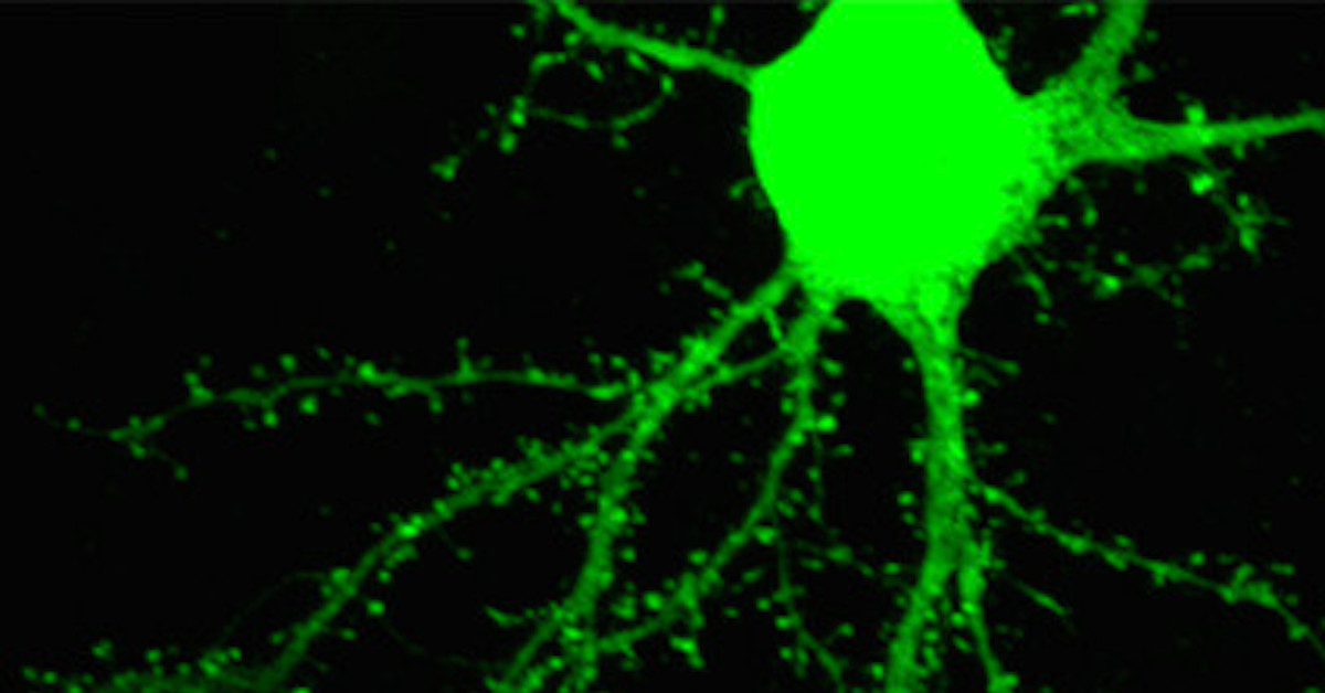 Scientists Pinpoint the Underlying Causes of Autism, Epilepsy, and Schizophrenia Scientists Pinpoint the Underlying Causes of Autism, Epilepsy, and Schizophrenia