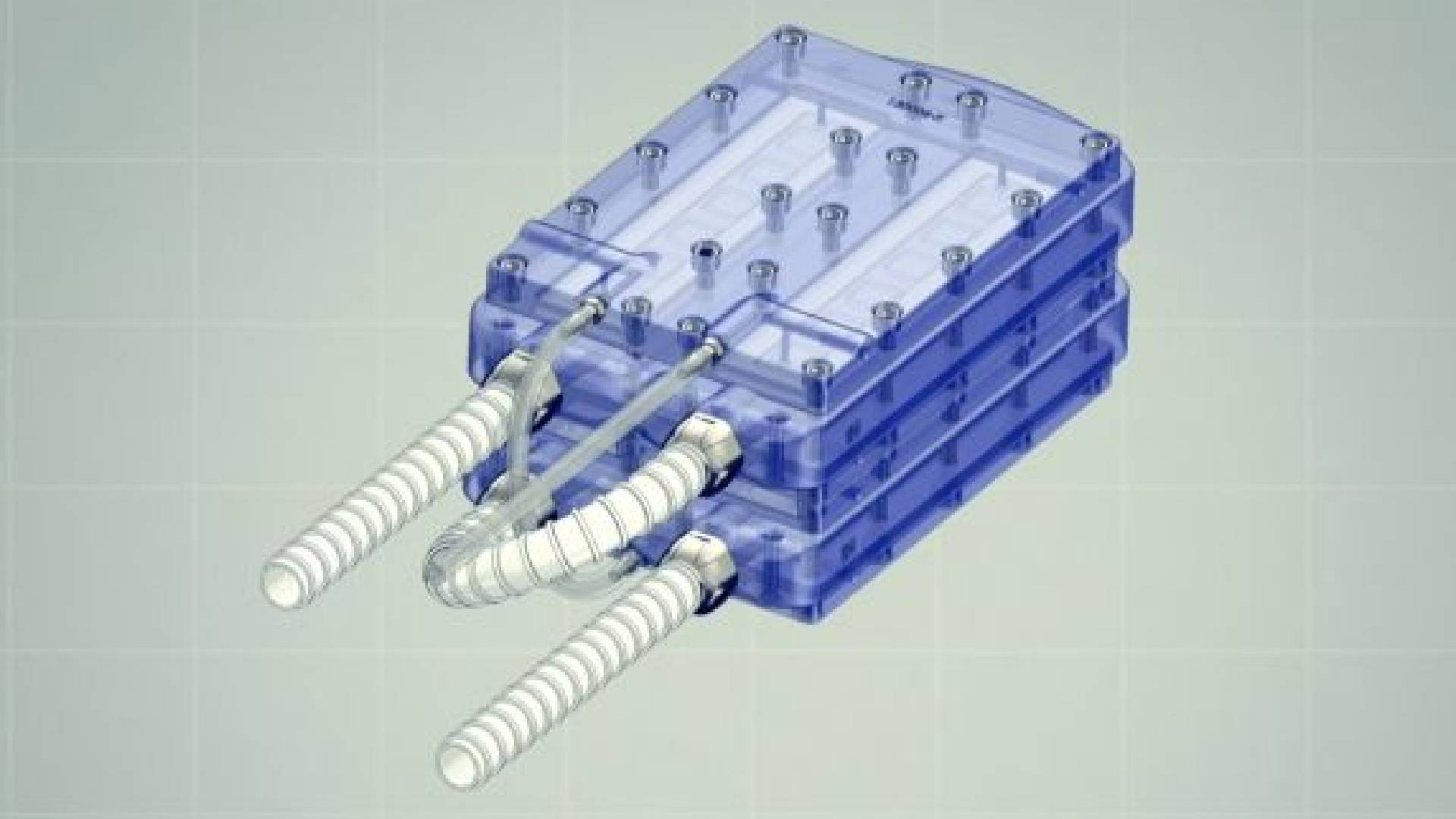 The World's First Artificial Kidney Could Finally Free People From Dialysis