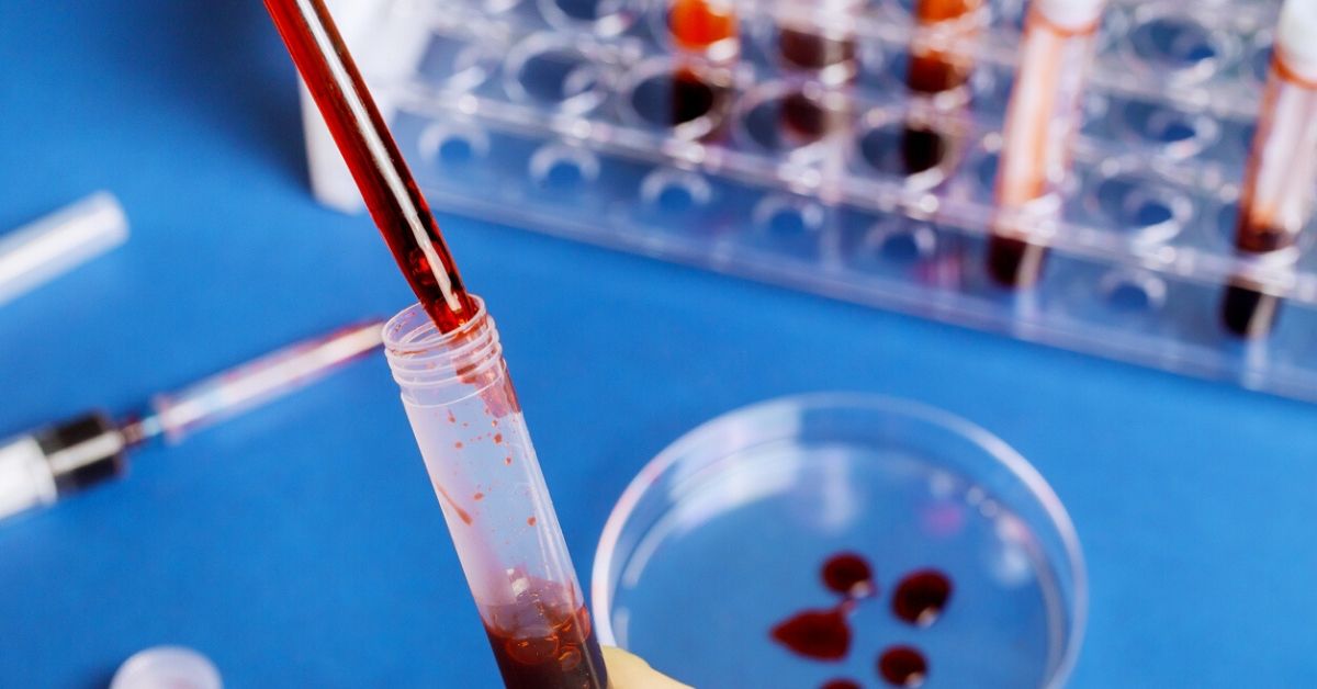 New Blood Test's Promising Results Detect Over 50 Types of Cancer Early