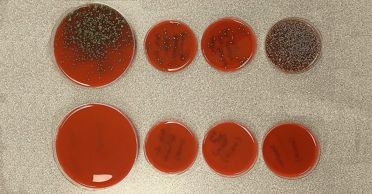 Mask vs. No Mask Demonstration Shows How Important It Is to Wear One