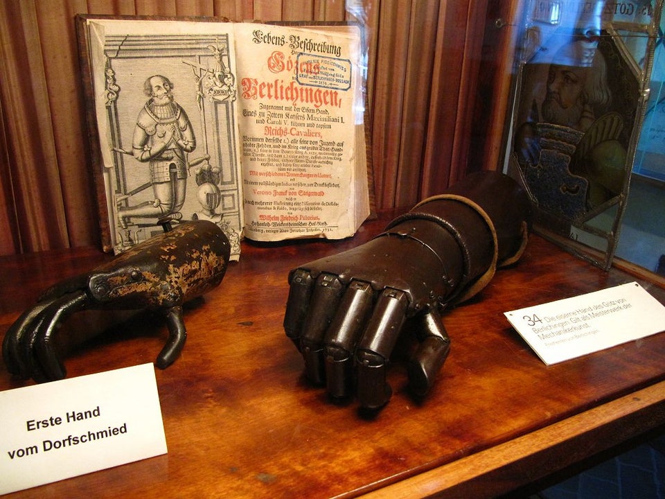 prosthetic limbs in history germany