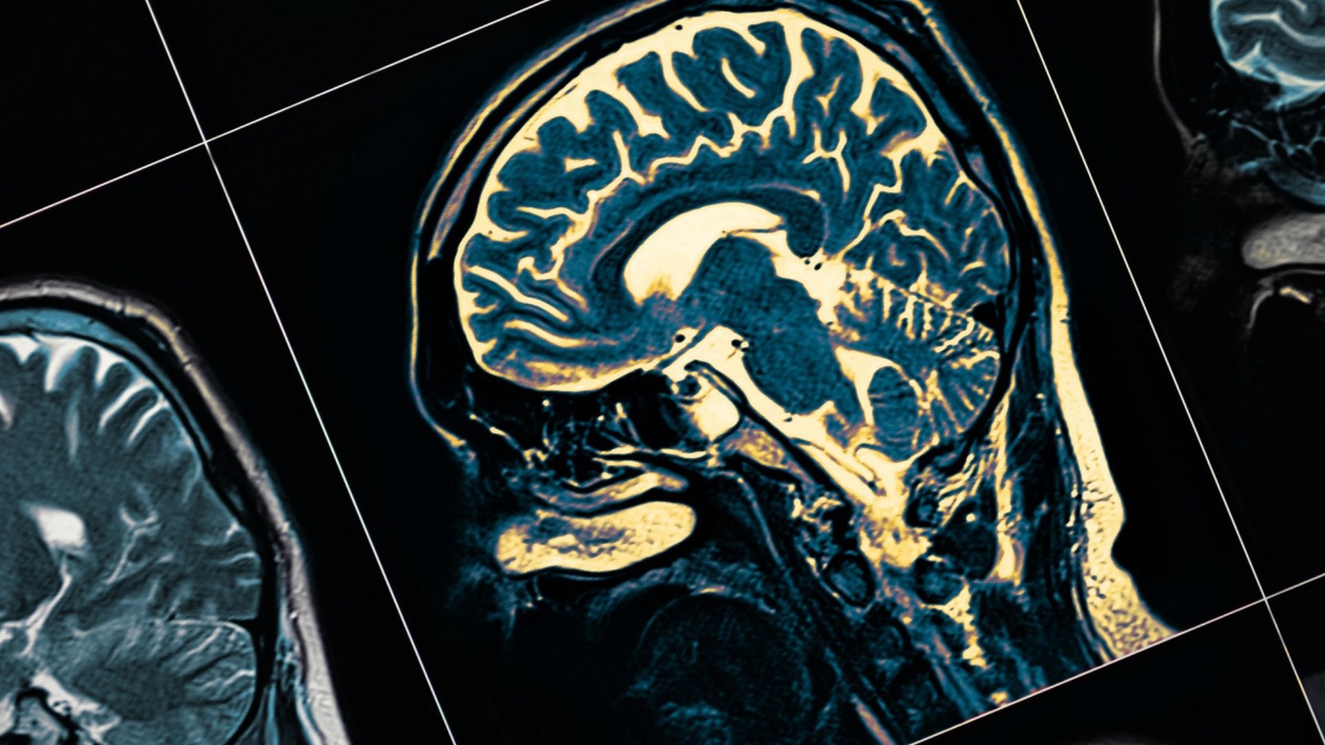 how the brain works