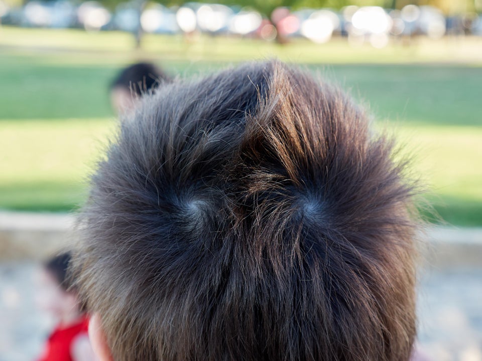 genetic conditions mohawk